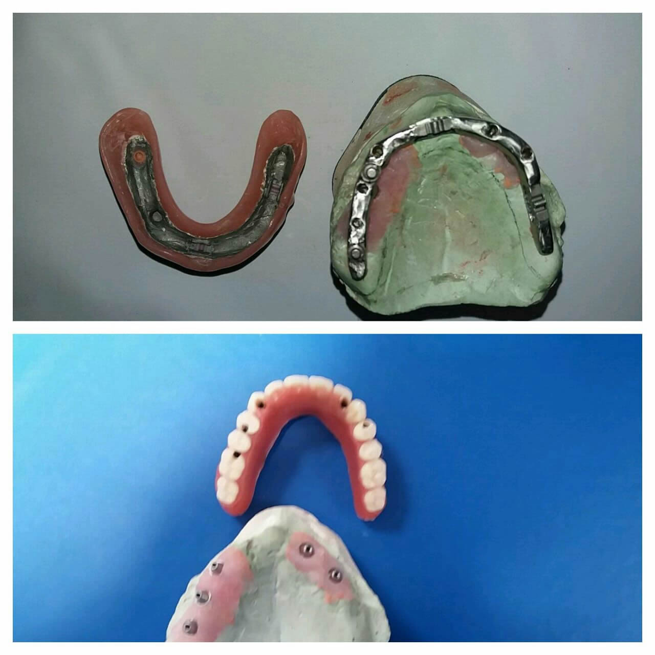 Dental Mejia 