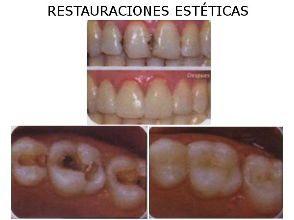 Dr.  Santiago   Serrano Piedra 
Odontólogo 
